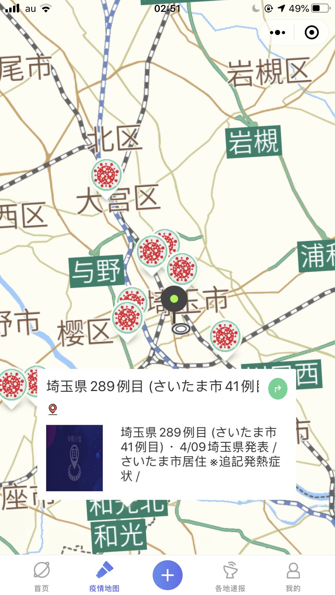 地图单独做一页～不用授权位置也能查看。